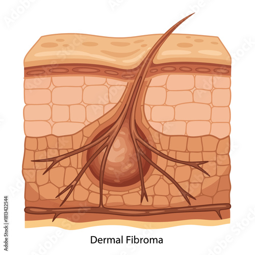 Cross-section of human skin showing a hair follicle, sebaceous gland, and nerve endings