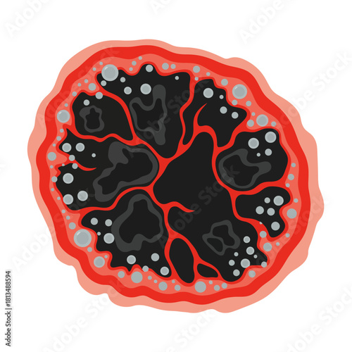 Detailed cross-section illustration of a complex biological mass with layered structure and internal