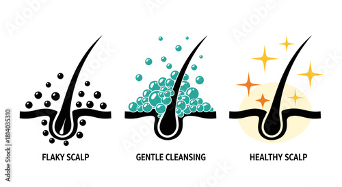 Hair Scalp Health Visualization: Demonstrating Flaky Scalp, Gentle Cleansing, and Healthy Scalp Conditions in a Medical Illustration for Dermatological, Beauty, and Healthcare Education (199/200)
