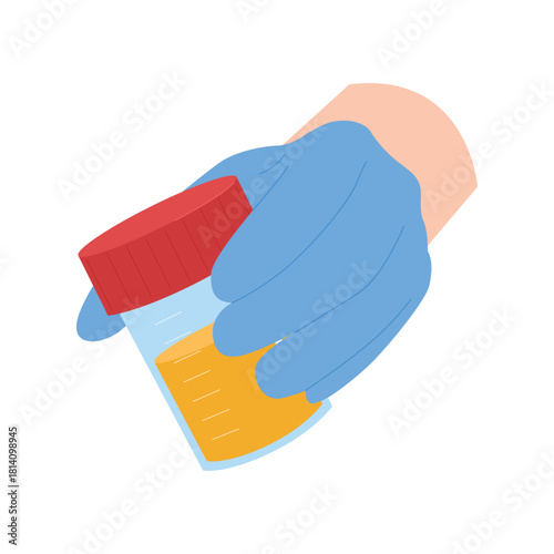 Isolated medical gloved hand holding urine test sample container for laboratory analysis vector illustration