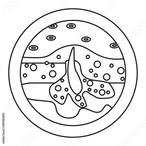  Clogged Pores and oily skin acne illustration 