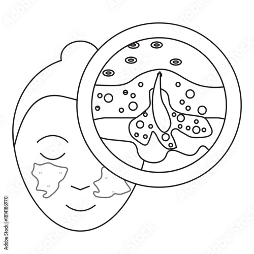 Oily Skin and Clogged Pores with Acne line icon