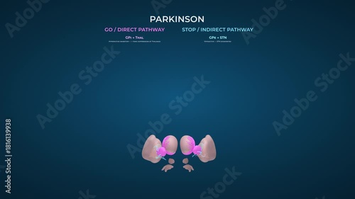 Basal Ganglia Neural Changes in Parkinson Disease on Solid Blue Background
