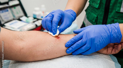 Medic hands in gloves cleaning wound on arm first aid emergency care medical treatment injury disinfection healthcare volunteer assistance trauma blood sterile procedure closeup doctor rescue safety 