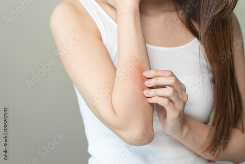 Sensitive skin allergic concept, Woman itching on her arm have a red rash from allergy symptom and from scratching.