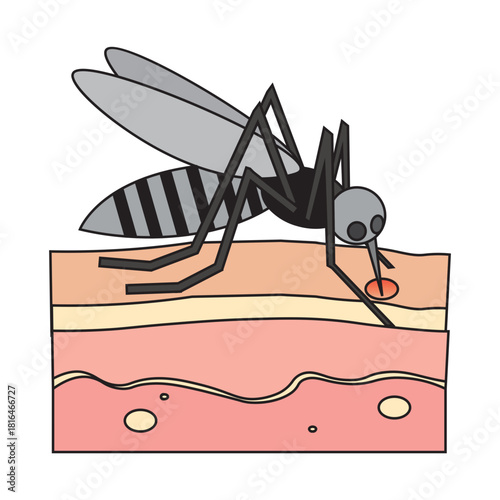 Mosquito Bites on Human Skin