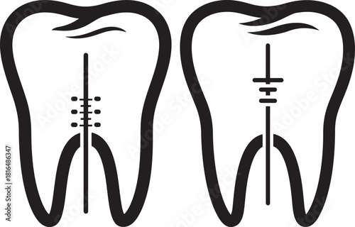 Two dental molar silhouettes showing root canal treatment stages silhouette