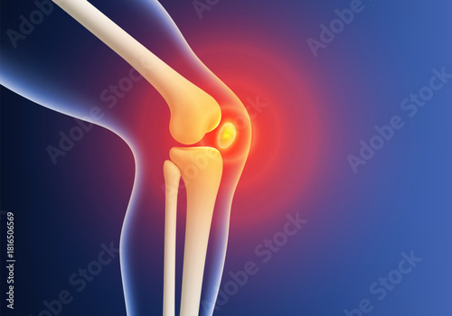3D knee pain visualization. Leg bones with red inflammation glow at joint area. Biological and medical concept. Vector illustration_1