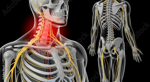 Anatomical illustration showcasing the human skeletal system and nervous system with neck pain highlighted