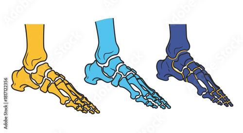 Anatomical illustration showing the bones of the human foot in three stages