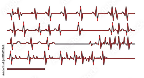 Heartbeat graph showing different rhythms, perfect for medical designs