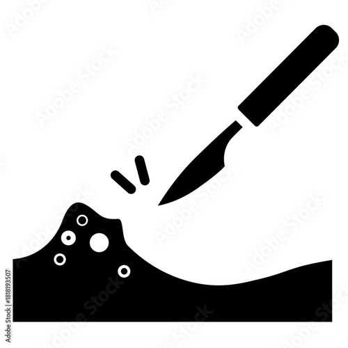 Wart Removal icon vector image. Can be used for Dermatology.