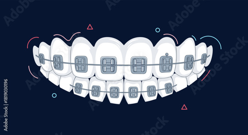 A stylized vector illustration of human teeth with dental braces, representing modern orthodontic treatment and oral health care.