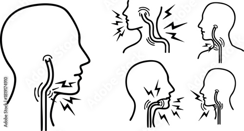 Human throat pain illustration showing different throat discomfort symptoms vector design medical concept