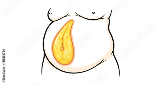 Visceral fat depiction in human abdomen illustration promoting health awareness