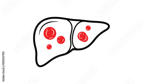 Hand drawn illustration of a diseased liver with red spots representing damage or illness