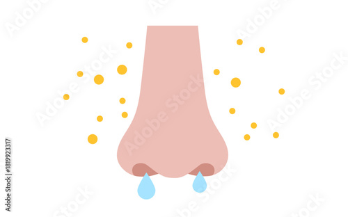 Allergic rhinitis poster