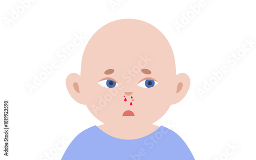 Nosebleed medical poster