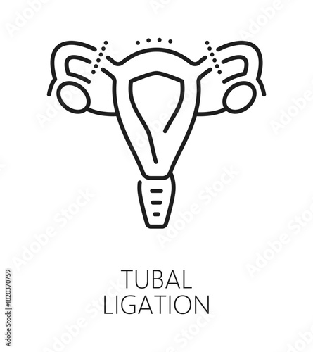 Tubal ligation contraception method line icon or label. Pregnancy prevention method outline vector symbol, contraception technique icon. Birth control procedure sign with uterus cut fallopian tubes