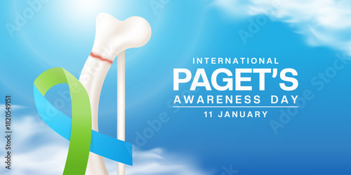 January 11 is International Pagets Awareness Day. Ribbon, bone, cloud and sun. Great for cards, banners, posters, social media and more. Blue background.   