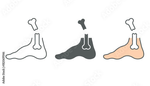 Illustration of a broken foot bone, symbolizing injury and pain