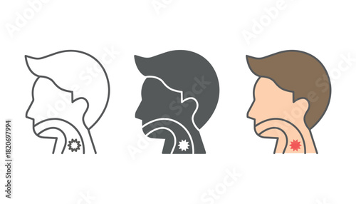 Illustration of a person's head profile showing sore throat and infection
