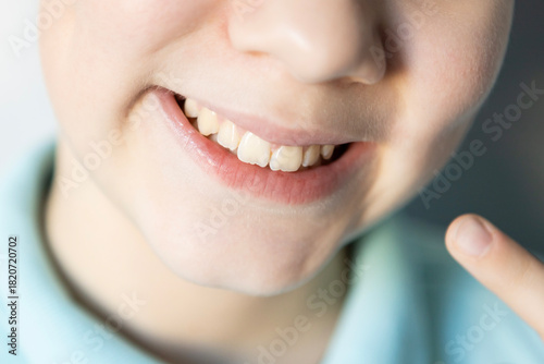 Child showing off a big smile with a missing tooth in a cheerful moment at home
