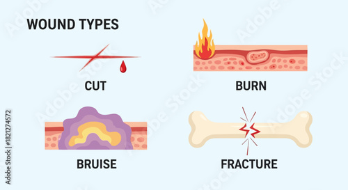 Showing different types wounds cut, burn, bruise, and fracture