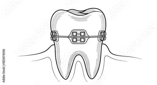 Close-up black and white illustration of a human tooth with orthodontic braces.