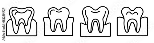 Set of four outline icons depicting human teeth and gum structures, illustrating various dental conditions or anatomical views