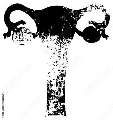 Uterus Illustrates Anatomy in Medical Education