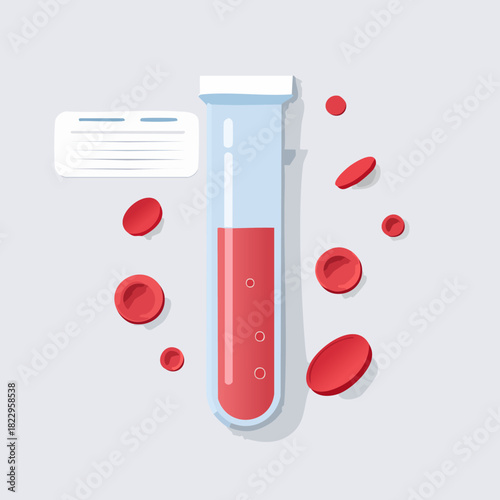 Blood Sample Analysis in Test Tube with Red Cells.