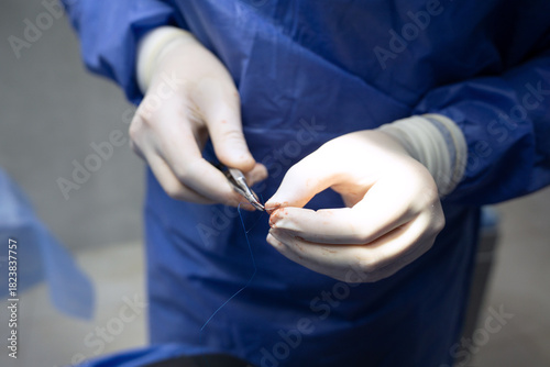 The doctor is holding a medical needle and surgical instruments, suturing a patient's wound in the operating room.