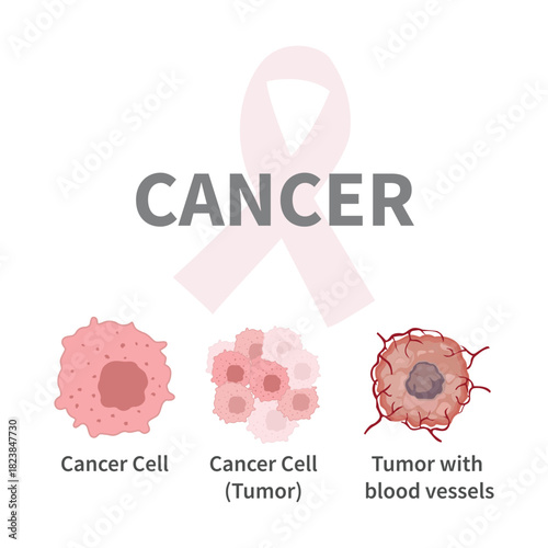 Cancer Cells: Definition, Morphology, Types illustration on whtie background