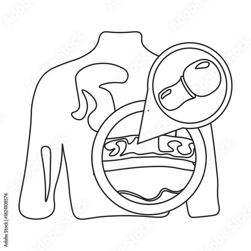 Tinea Versicolor on Human Back Skin line icon