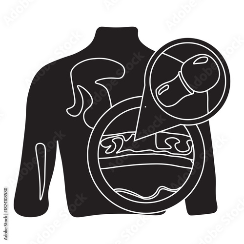 Tinea Versicolor on Human Back Skin glyph icon