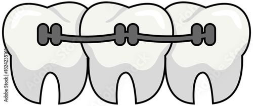 Dental Braces Lineart Illustration Editable Color Vector