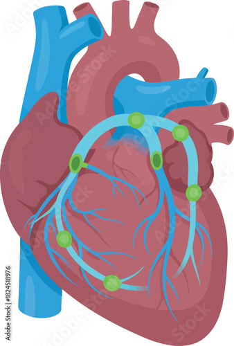 Medical illustration depicting a human heart with arteries highlighted, showing blood flow.
