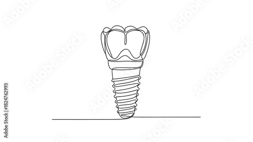 Dental implant design in a minimalist style on white background  