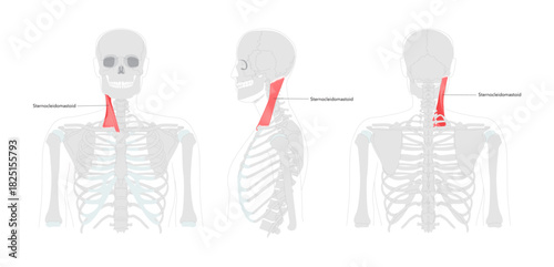 Sternocleidomastoid - Human neck muscle labeled anatomy chart, with two heads originating from sternum and clavicle, inserts at mastoid process, responsible for head rotation, lateral flexion,