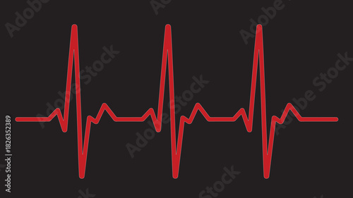 Red electrocardiogram tracing displaying a normal sinus rhythm on black