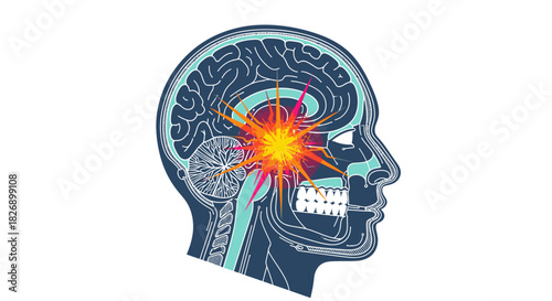 An illustrative depiction of a human head with a highlighted brain and an explosion effect, symbolizing a headache or brain trauma.