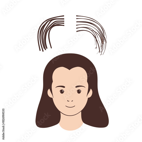 Minimalist vector illustration of young man with hair loss showing thinning hair and receding hairline in flat style