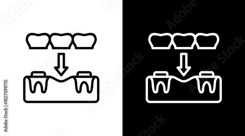 Dental Bridge  White Icon Set Design