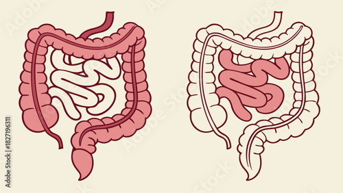 Diagram of human intestines showing large and small sections