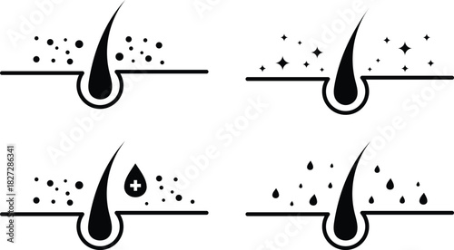 Clean Hair Follicle Care Icons – Dandruff Removal, Scalp Treatment, Moisture & Nourishing Hair Vector Set