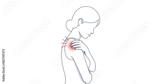 Woman receiving acupuncture treatment on her shoulder with red inflammation and needles shown clearly
