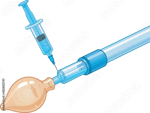 Medical illustration showing a syringe injecting liquid into a medical device.