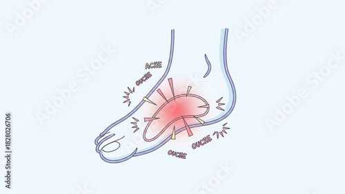 Illustration of a foot experiencing pain in the arch area with ache and ouche text around it