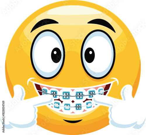 Happy Smiling Emoji Face with Blue Dental Braces Showing Teeth Orthodontic Treatment Vector Cartoon Icon Emoticon Design.